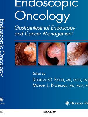 Endoscopic Oncology - Faigel, Douglas O (Editor)