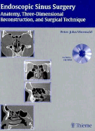 Endoscopic Sinus Surgery: Anatomy, Three-Dimensional Reconstruction, and Surgical Technique