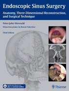 Endoscopic Sinus Surgery: Anatomy, Three-Dimensional Reconstruction, and Surgical Technique