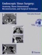 Endoscopic Sinus Surgery: Anatomy, Three-dimensional Reconstruction, and Surgical Technique