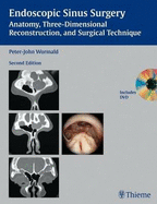 Endoscopic Sinus Surgery: Anatomy, Three-dimensional Reconstruction, and Surgical Technique