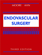 Endovascular surgery