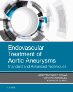 Endovascular Treatment of Aortic Aneurysms: Standard and Advanced Techniques