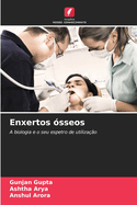 Enxertos ?sseos