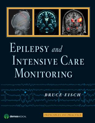 Epilepsy and Intensive Care Monitoring: Principles and Practice - Fisch, Bruce, MD