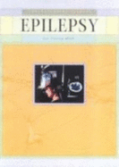 Epilepsy
