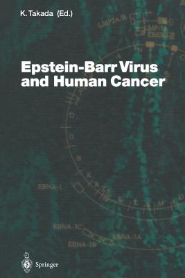 Epstein-Barr Virus and Human Cancer - Takada, K (Editor)