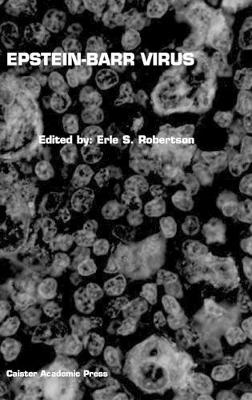 Epstein-Barr Virus - Robertson, Erle S (Editor)