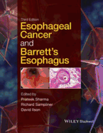 Esophageal Cancer and Barrett's Esophagus