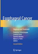 Esophageal Cancer: Diagnosis and Treatment