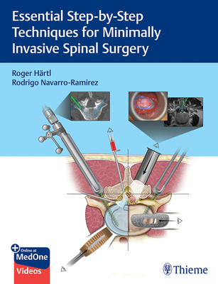 Essential Step-By-Step Techniques for Minimally Invasive Spinal Surgery - Hartl, Roger, and Navarro-Ramirez, Rodrigo