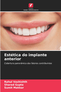 Est?tica do implante anterior