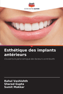 Esth?tique des implants ant?rieurs