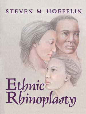 Ethnic Rhinoplasty - Hoefflin, Steven M, MD