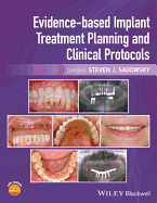 Evidence-based Implant Treatment Planning and Clinical Protocols