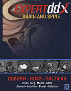 EXPERTddx: Brain and Spine: Published by Amirsys�