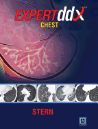 EXPERTddx: Chest: Published by Amirsys (R)