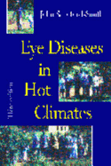 Eye Diseases in Hot Climates