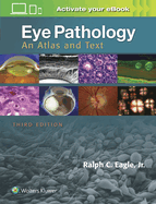 Eye Pathology: An Atlas and Text