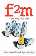 F2m