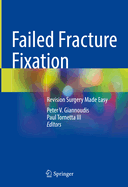 Failed Fracture Fixation: Revision Surgery Made Easy