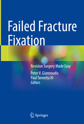 Failed Fracture Fixation: Revision Surgery Made Easy - Giannoudis, Peter V (Editor), and Tornetta III, Paul (Editor)
