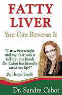 Fatty Liver: You Can Reverse It