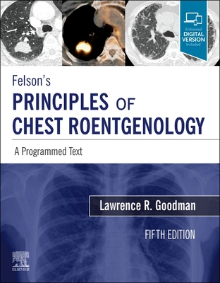 Felson's Principles of Chest Roentgenology, A Programmed Text: A Programmed Text - Goodman, Lawrence R., MD