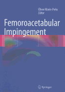 Femoroacetabular Impingement
