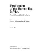 Fertilization of Egg in Vitro