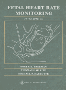 Fetal Heart Rate Monitoring