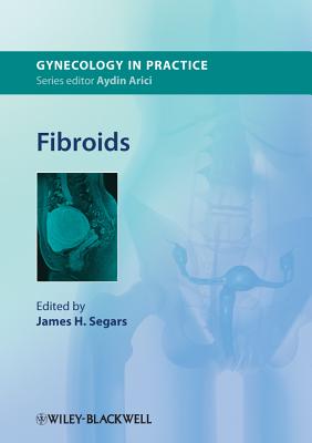 Fibroids - Segars, James H. (Editor)