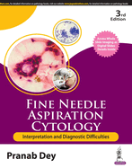Fine Needle Aspiration Cytology: Interpretation and Diagnostic Difficulties