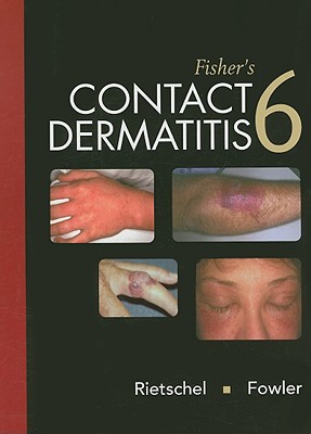 Fisher's Contact Dermatitis - Rietschel, Robert L, and Fowler, Joseph F