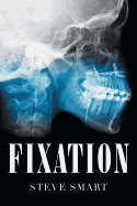 Fixation