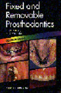 Fixed and Removable Prosthodontics: Colour Guide