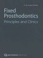 Fixed Prosthodontics: Principles and Clinics