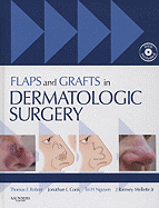 Flaps and Grafts in Dermatologic Surgery: Text with DVD