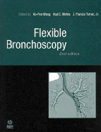 Flexible Bronchoscopy