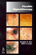 Flexible Sigmoidoscopy