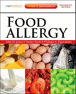 Food Allergy