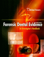 Forensic Dental Evidence: An Investigator's Handbook