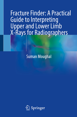 Fracture Finder: A Practical Guide to Interpreting Upper and Lower Limb X-Rays for Radiographers - Moughal, Suman