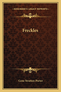 Freckles