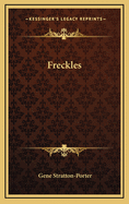 Freckles