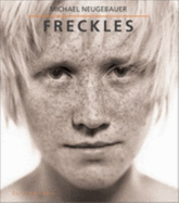 Freckles