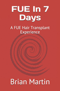 FUE In 7 Days: A FUE Hair Transplant Experience