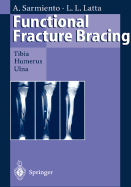 Functional Fracture Bracing: Tibia, Humerus, and Ulna