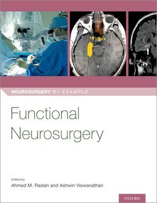 Functional Neurosurgery - Raslan, Ahmed (Editor), and Viswanathan, Ashwin (Editor)