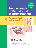 FUND OF PERIODONTAL INSTRUMENT & ADV ROOT 6E: .